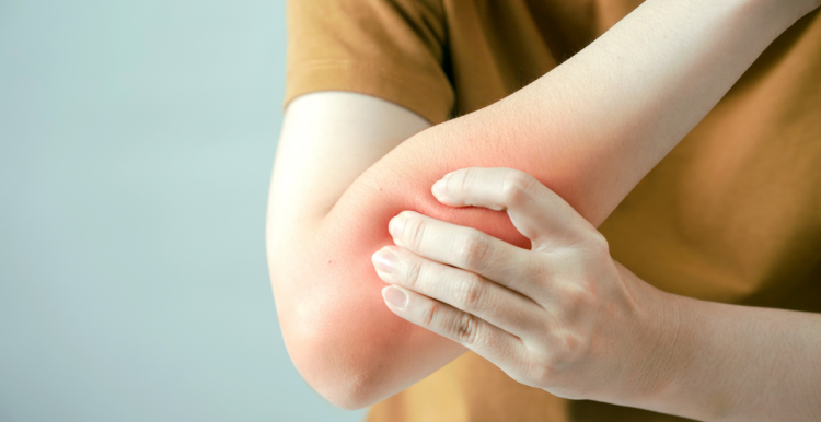 Your experiences of living with Fibromyalgia