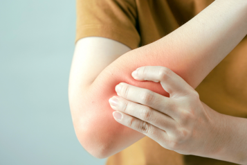 Your experiences of living with Fibromyalgia