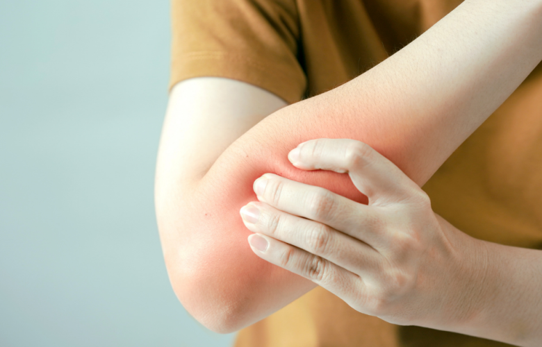 Your experiences of living with Fibromyalgia